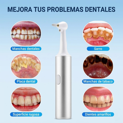 Pulidor Dental a Batería para Limpieza, Pulido y Eliminación de Sarro