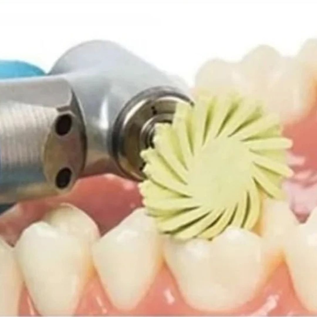 Sistema de Pulido Diamantado RA (baja velocidad) para Resina y Cerámica – 6 Piezas