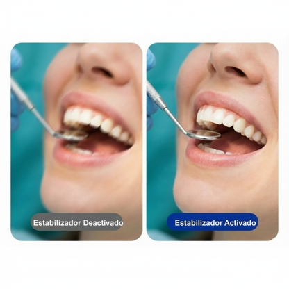 Cámara de grabación para procedimientos médicos, odontológicos y estéticos – 4K a 30 FPS